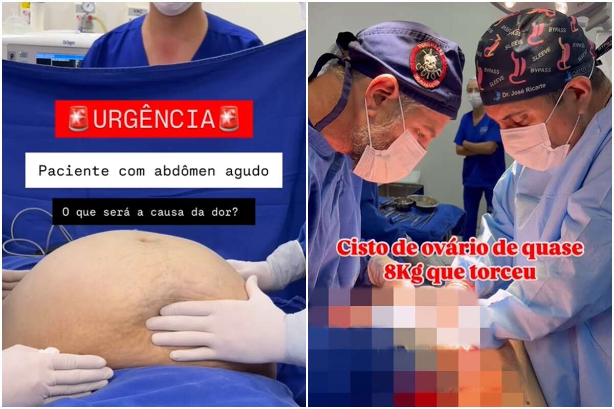 Médico retira cisto com quase 8 kg de paciente do Acre. Veja vídeo