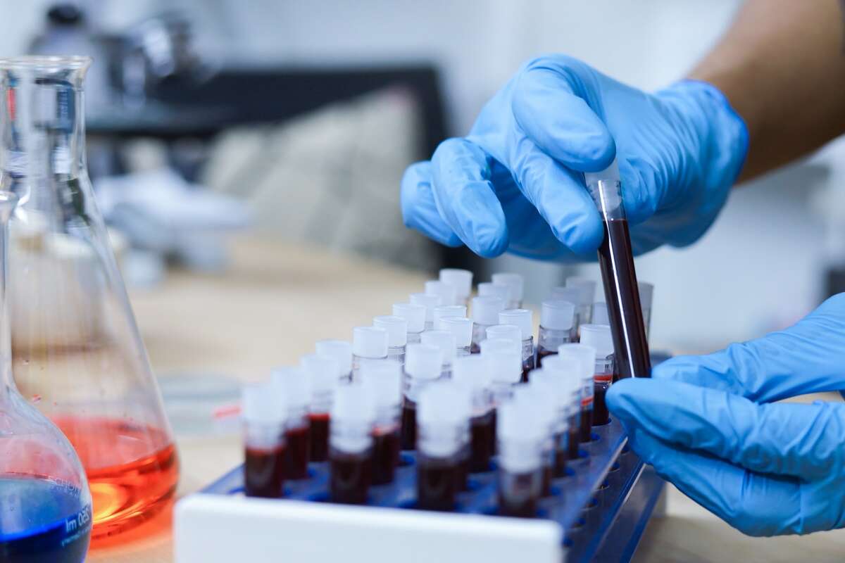 Primeiro teste de sangue para endometriose pode acelerar diagnóstico