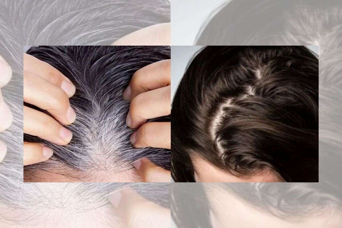 Xô, fios brancos! Tinta com chá comum devolve a cor natural ao cabelo