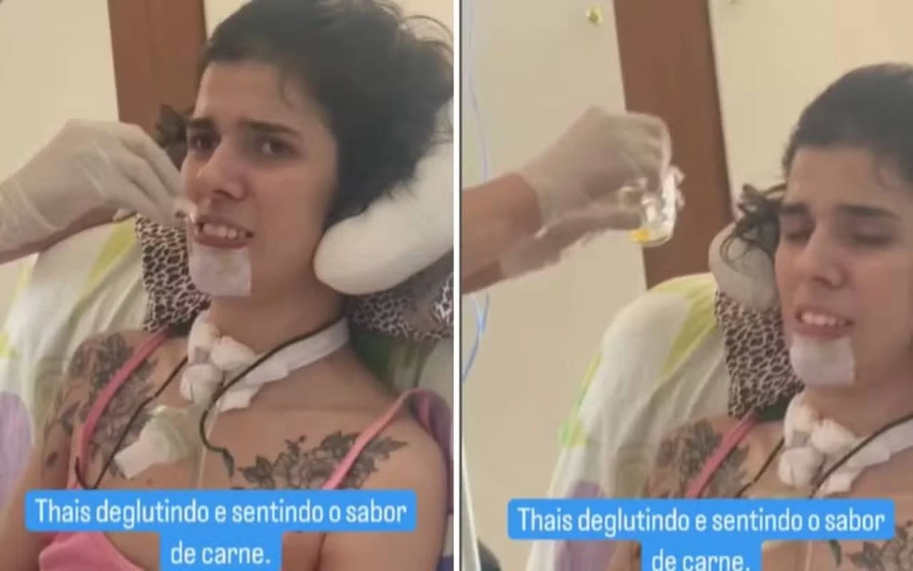 Justiça toma atitude para garantir home care a jovem que cheirou pimenta