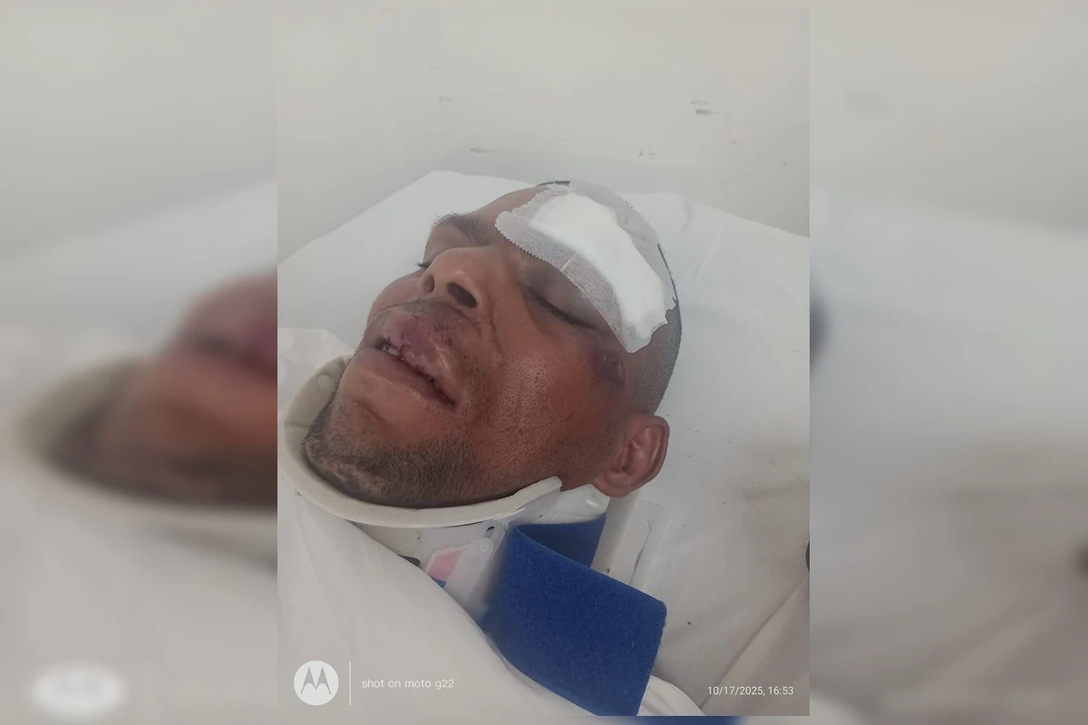 Vídeo: ciclista quase perde o braço ao ser atropelado por ônibus no DF