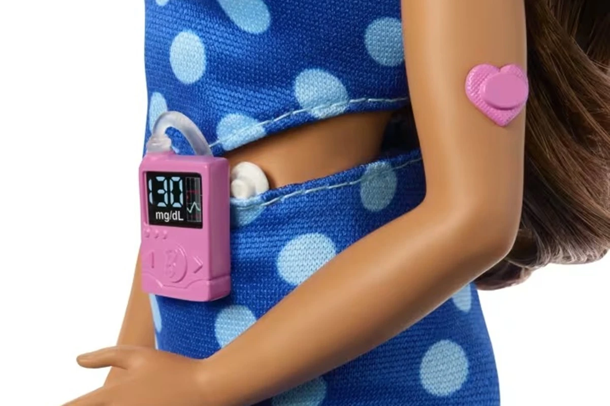 Monitor de glicose e insulina: Mattel lança Barbie com diabetes tipo 1