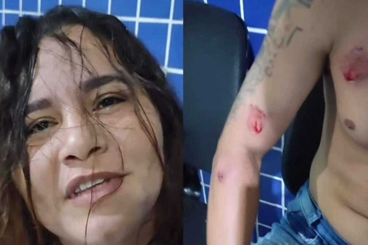 Mulher surta ao flagrar traição e ataca marido e amante a dentadas