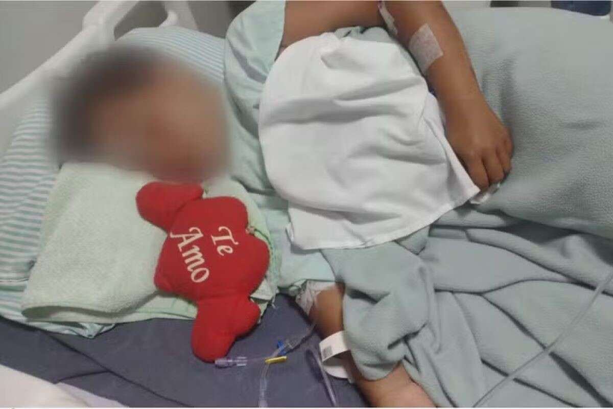 Menino de 9 anos fica gravemente ferido após ataque de pitbull em SP