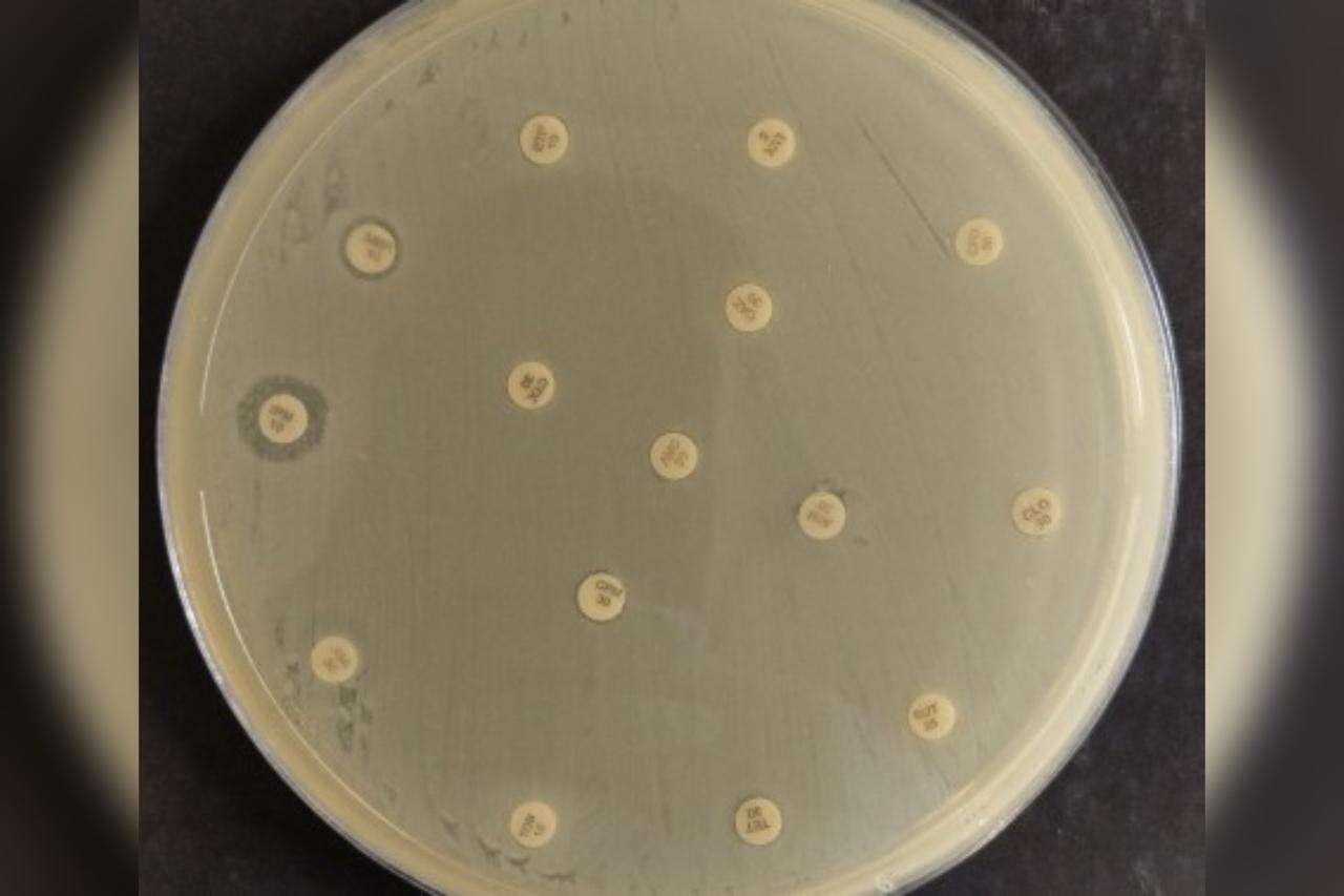 Brasileiros detectam bactéria multirresistente de risco global no NE