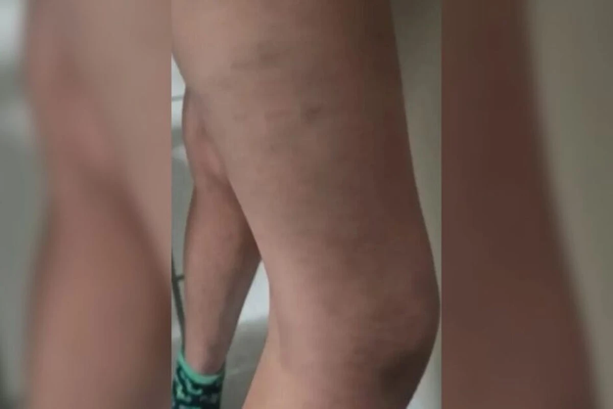 Pais usavam espeto de churrasco e pedaço de pau para torturar filhos