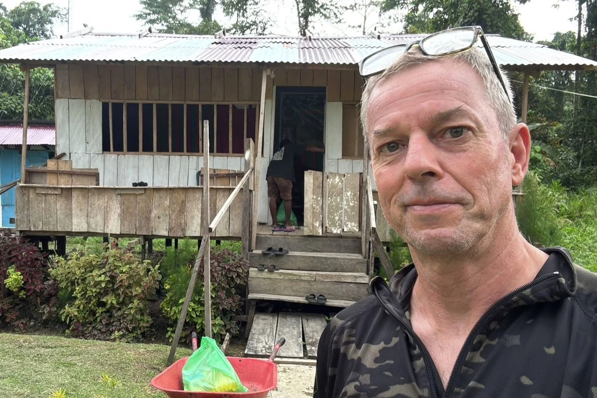 Após coceira constante, homem descobre sanguessuga no olho. Veja foto