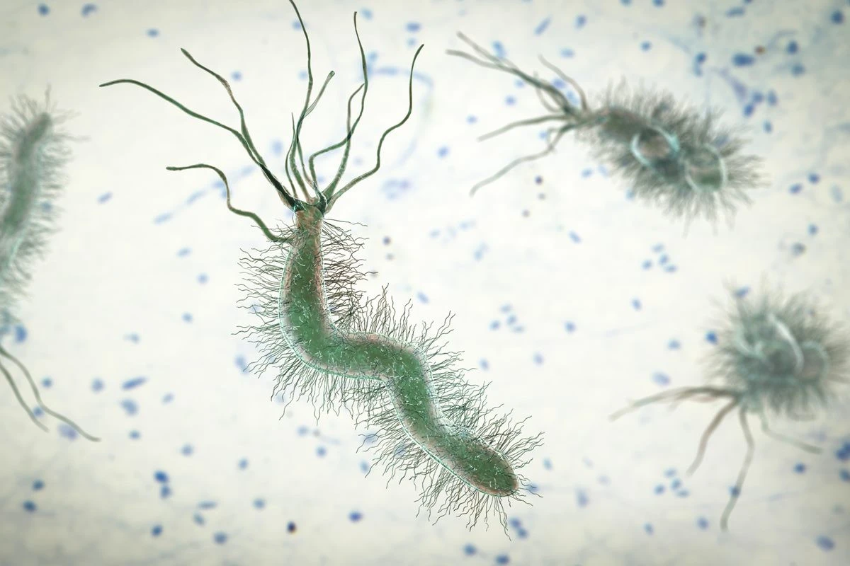 H. pylori: saiba sintomas da infecção que confundiu homem com câncer