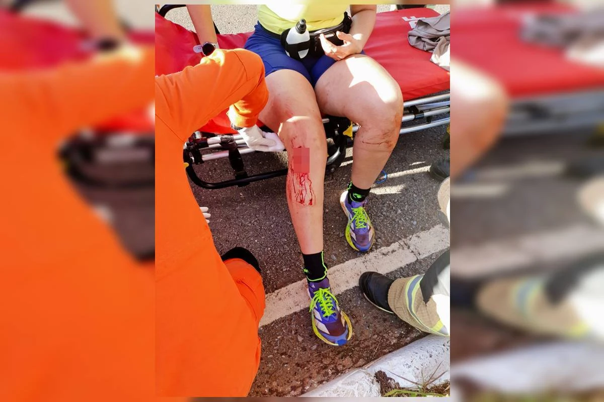 Vídeo: médica teve sangramento abundante após ser atacada por 10 cães