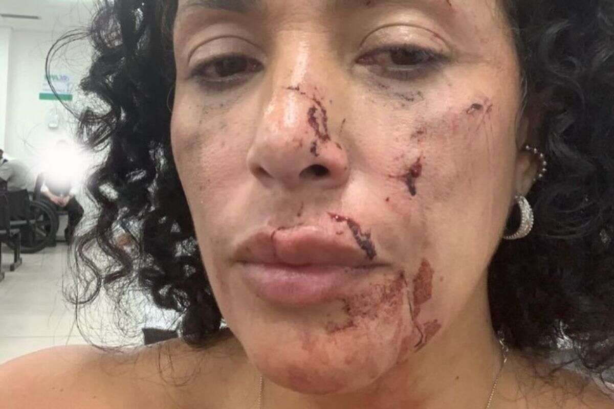 Mulher acusa dono de bar da Barra Funda de agressão: “Tentou me matar”