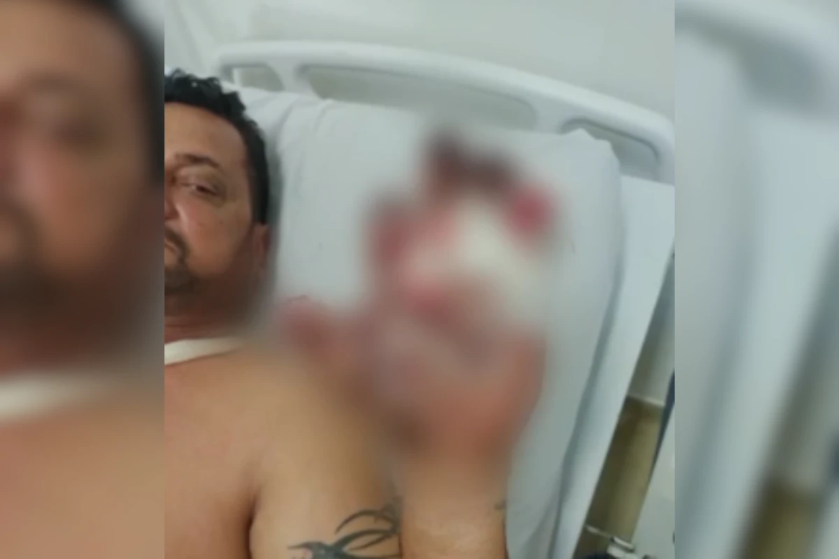 Pintor perde dedos da mão após bomba explodir em casa de ex-PM em SP