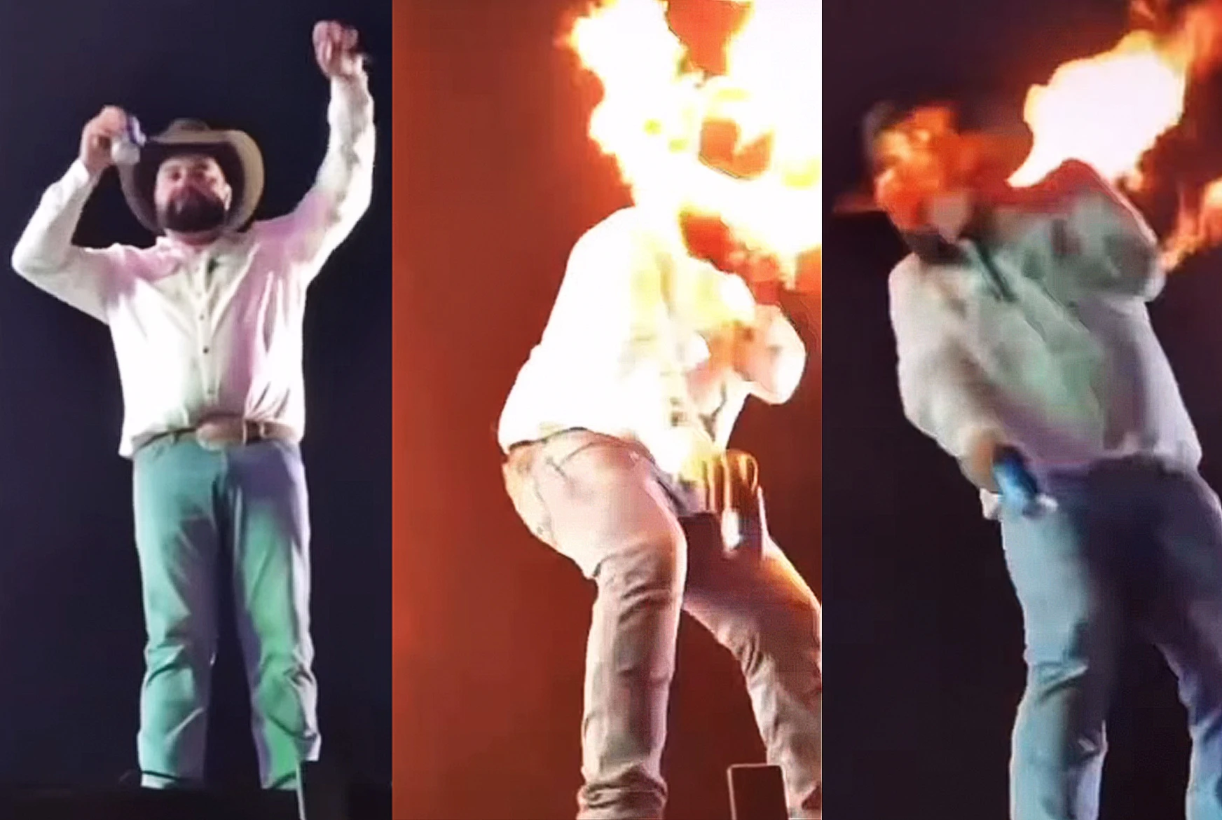 Cantor sertanejo tem rosto queimado após efeito especial dar errado