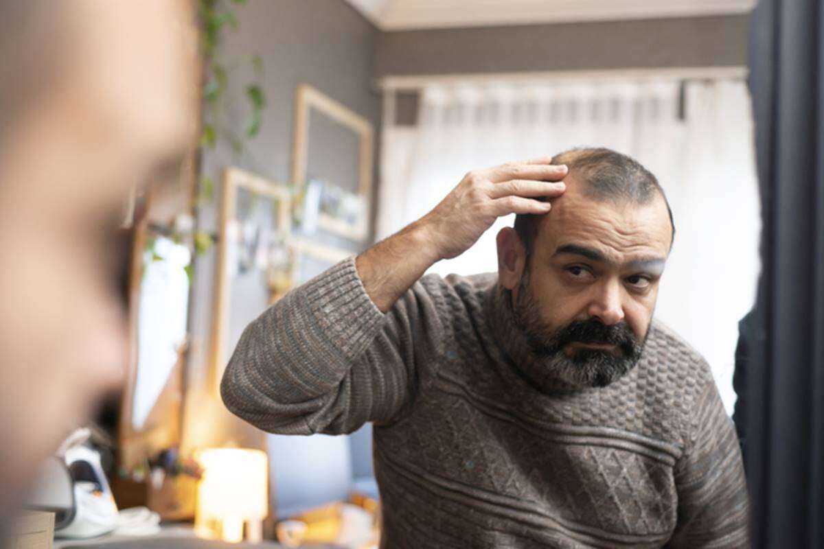 Gel de açúcar faz cabelos crescerem tanto quanto minoxidil, diz estudo