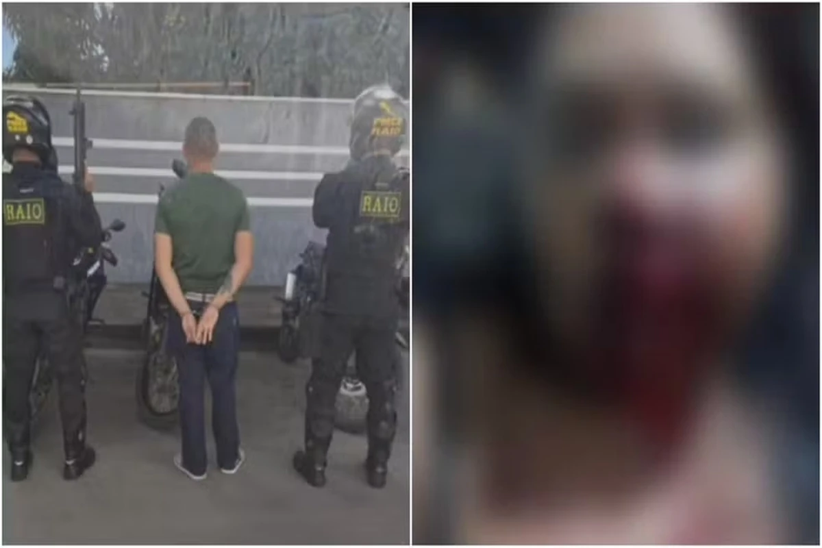 Homem é preso após desfigurar rosto de companheira enquanto dormia