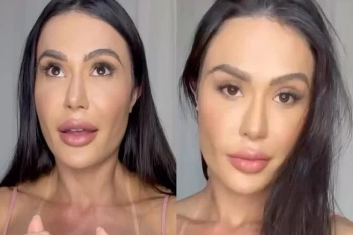 “Reaprendendo a andar”, diz Gracyanne Barbosa sobre cirurgia no joelho