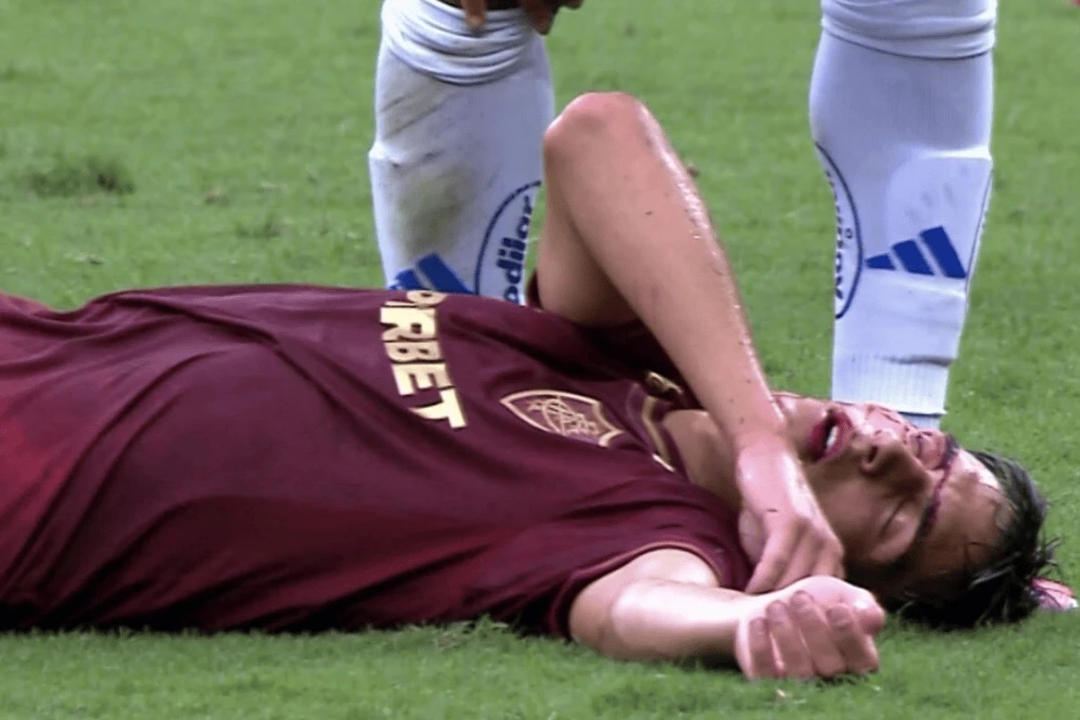 Vídeo: jogador do Fluminense cai ensanguentado após cotovelada