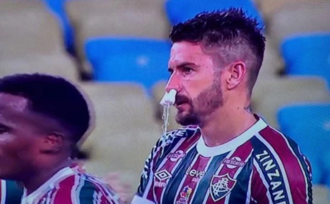 Everaldo, do Fluminense, usa absorvente no nariz para estancar sangue