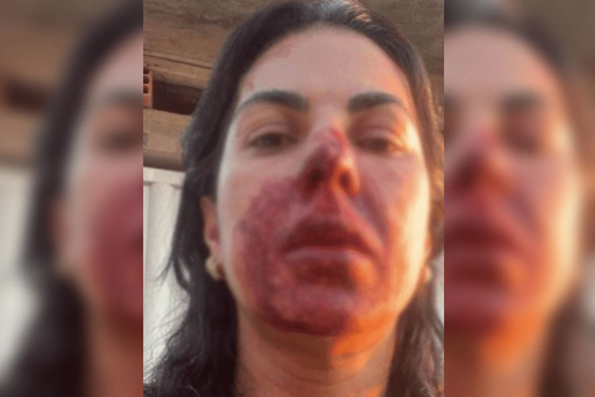 “Misógino”: PM que deu cabeçada em oficial de Justiça é condenado