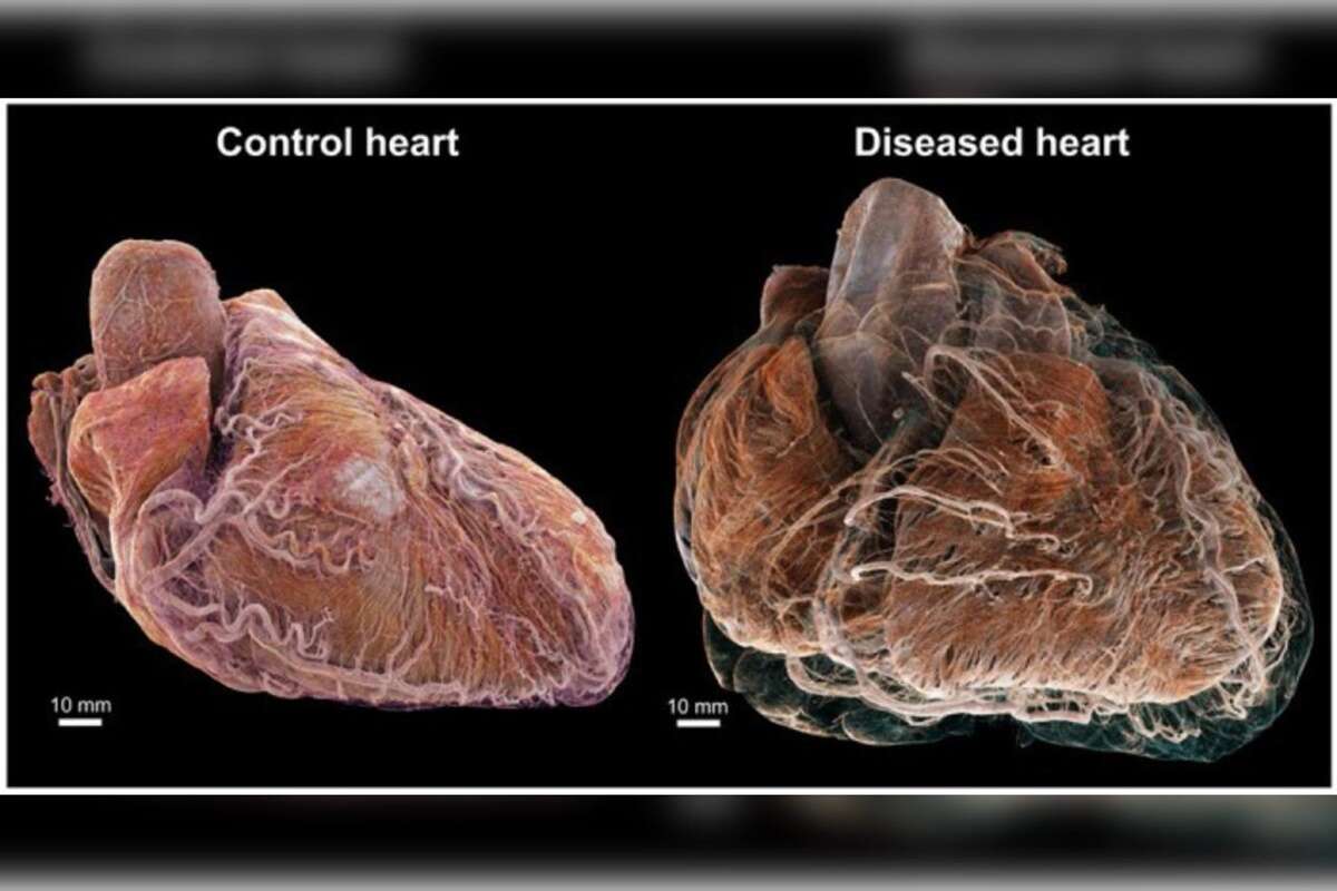 Vídeo: tecnologia 3D mostra um coração humano saudável e outro doente