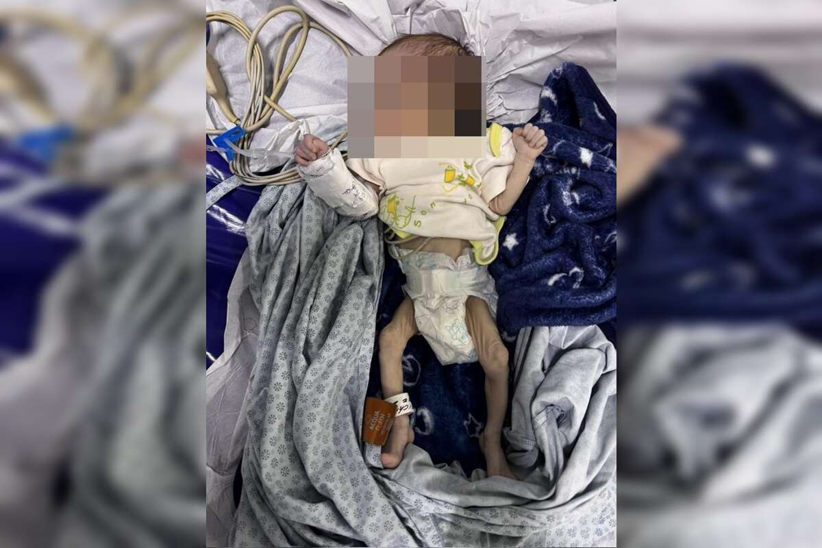 Crueldade: mãe não procura hospital e deixa filho à beira da morte