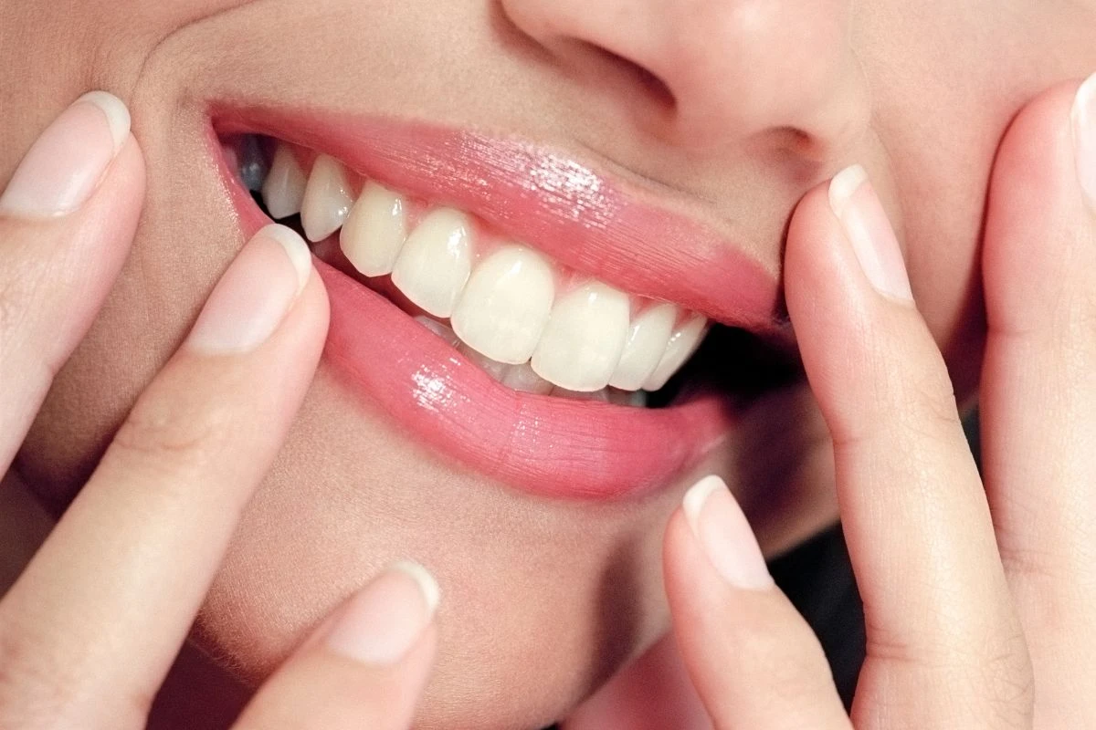 Clareamento dental com caneta funciona? Especialista responde