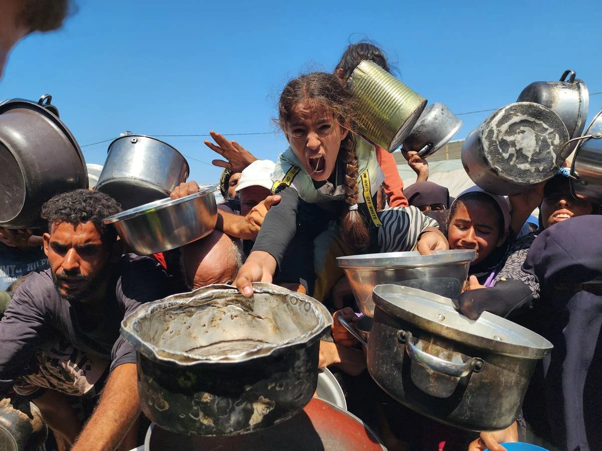ONU: 20% das crianças na Cidade de Gaza estão desnutridas