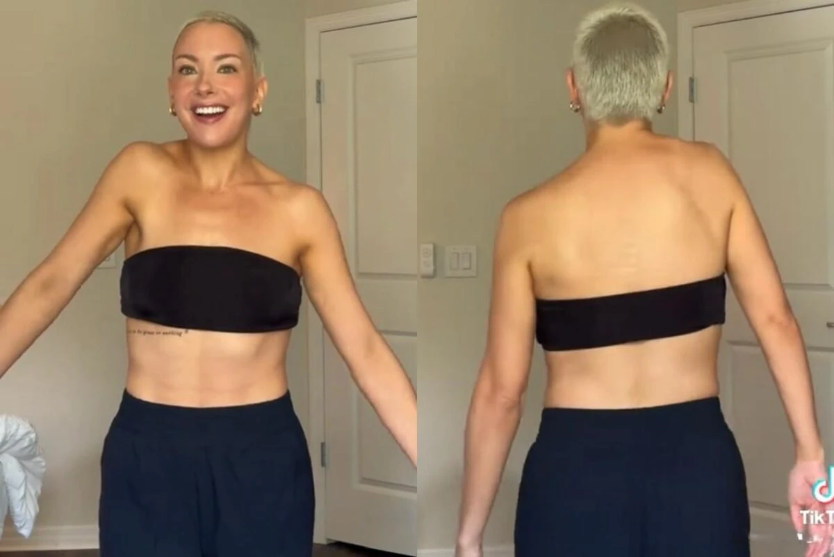 Mulher relata mudança misteriosa em seu ombro: “Levantando sozinho”