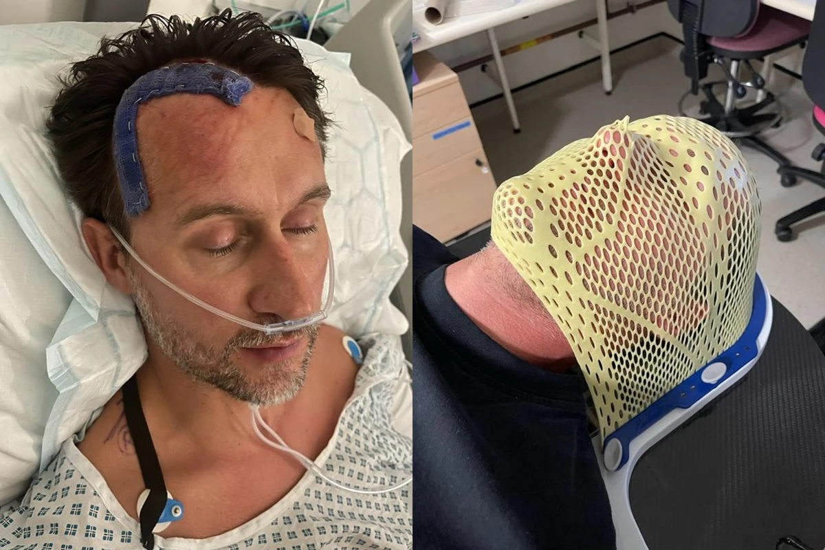 Homem descobre câncer após atribuir enxaquecas ao estresse da rotina