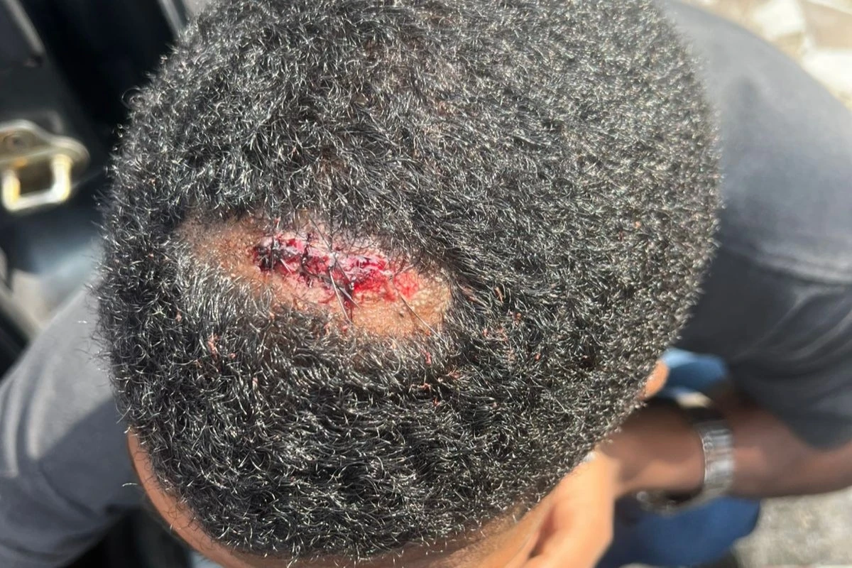 PM atira em homem sentado na calçada durante apreensão de motos. Veja