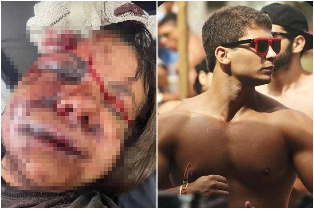 Mulher que levou 60 socos do namorado: “Ele disse que iria me matar”