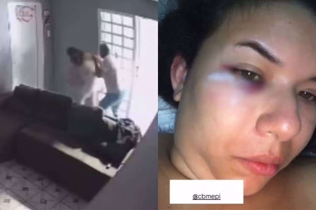 Violência: no Piauí, jornalista denuncia agressões do marido sargento