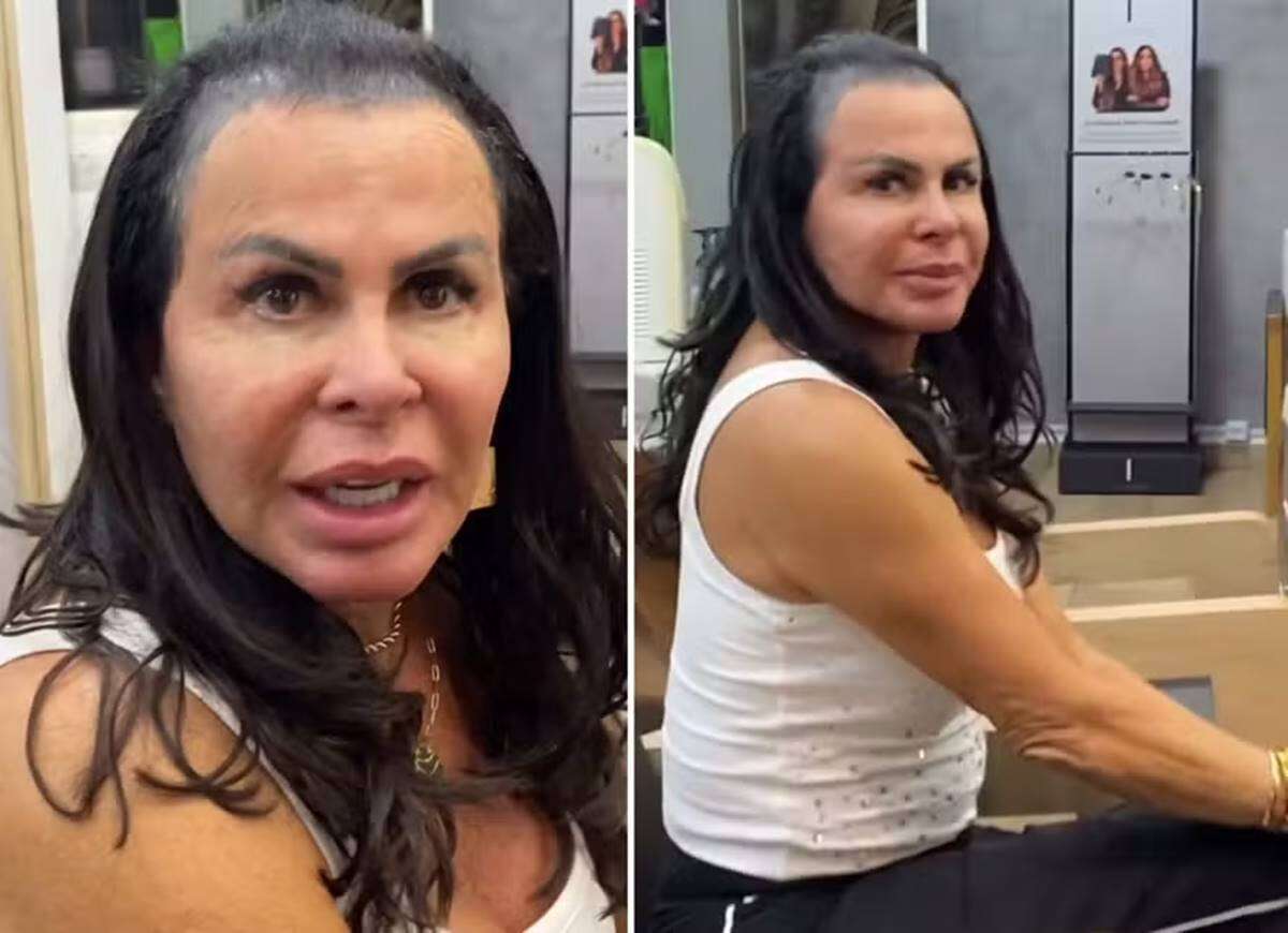 Vídeo: Gretchen mostra calvície antes de realizar aplicação no cabelo