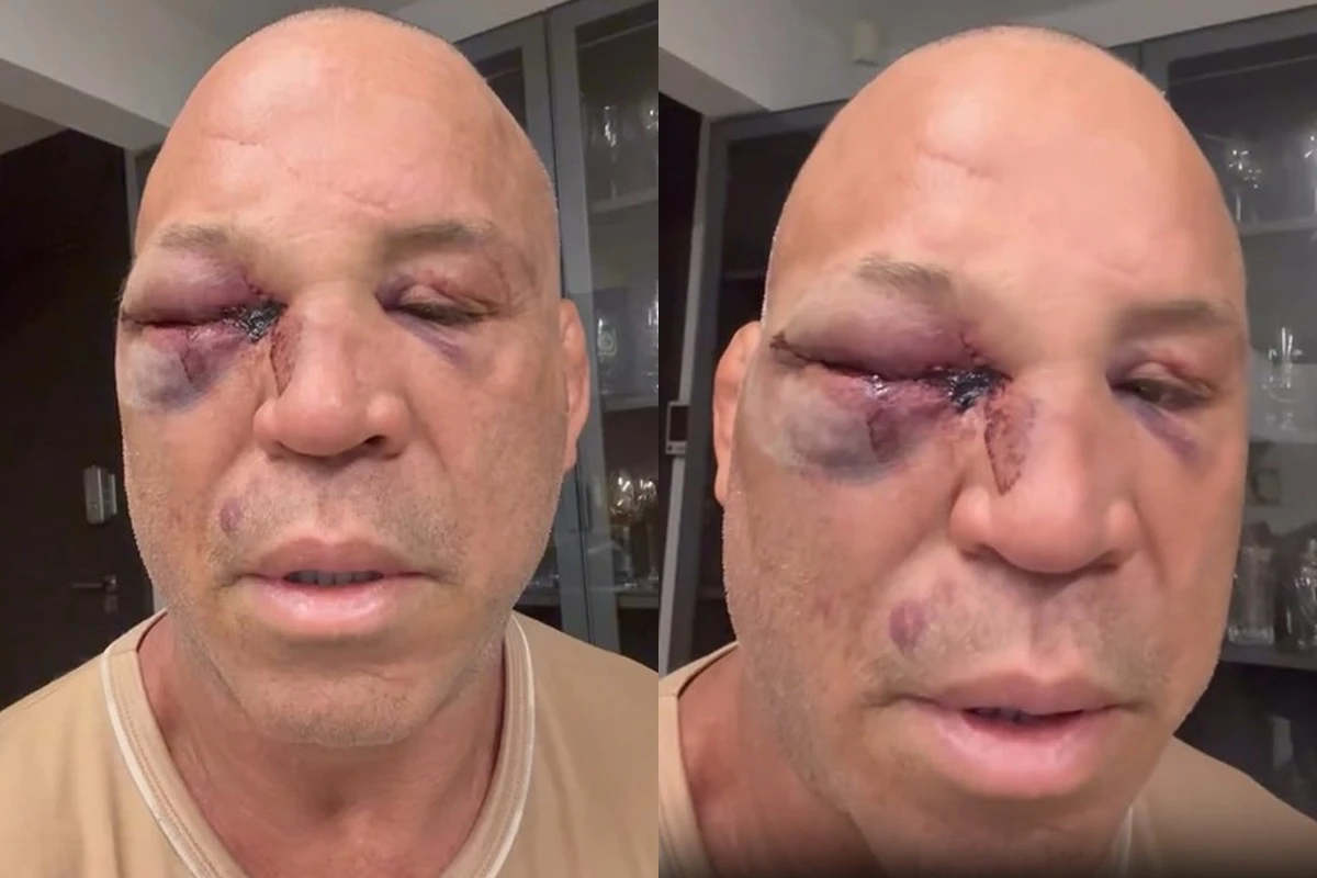 Empresário de Wanderlei Silva pede anulação da vitória de Popó