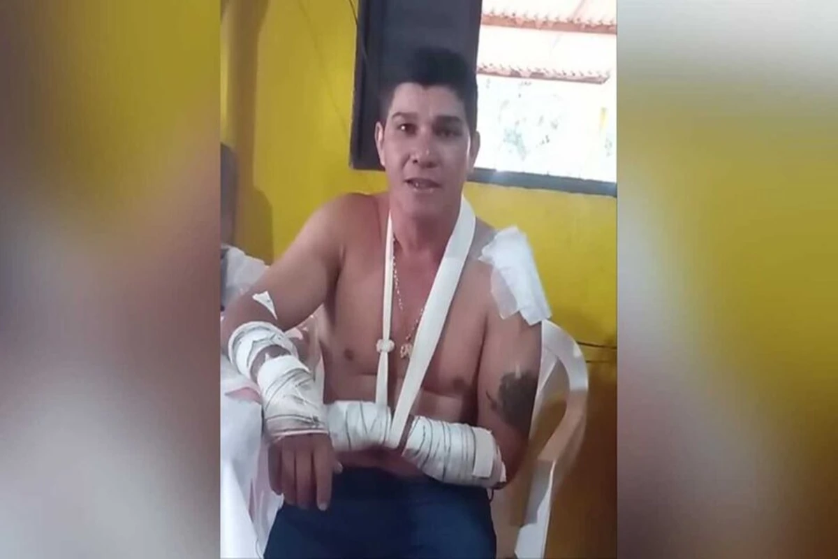 Motociclista que sobreviveu a ataque de onça em MS conta experiência