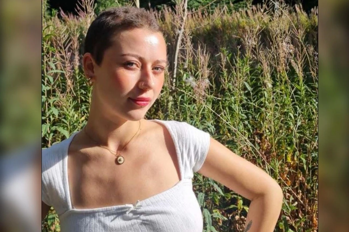 Jovem de 23 anos perde todo o cabelo após crise de estresse no trabalho