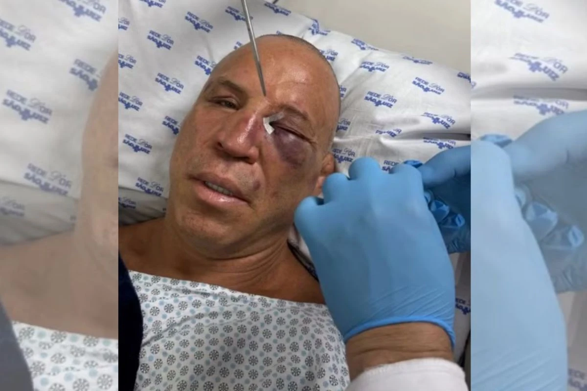 Wanderlei Silva foi ao hospital após nocaute em confusão generalizada