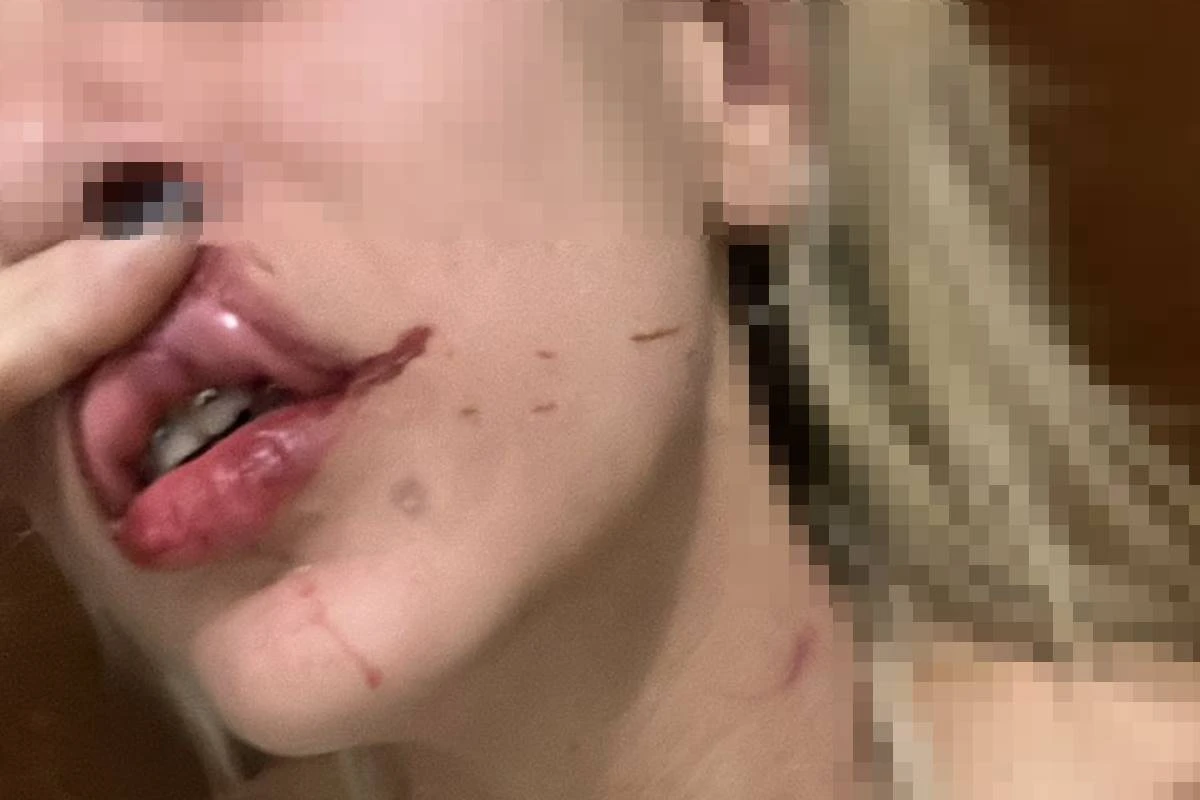 PM do DF é acusado de usar viatura para perseguir ex após agressões