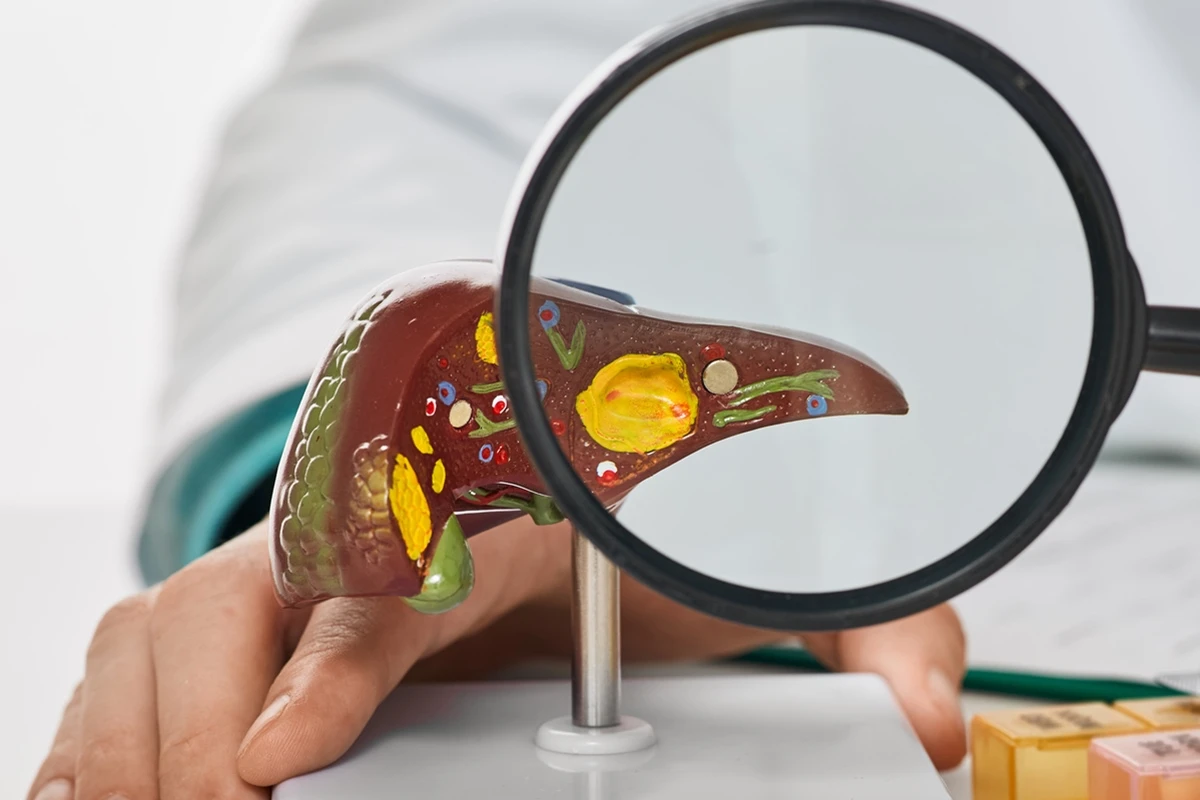 Nutri lista 4 grãos populares que ajudam a reduzir a gordura no fígado