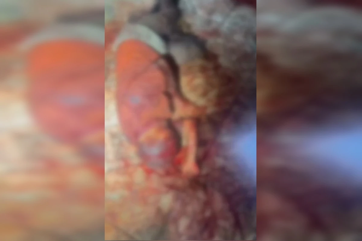 Idoso é encontrado em lamaçal de sangue ao ser esfaqueado por sobrinho