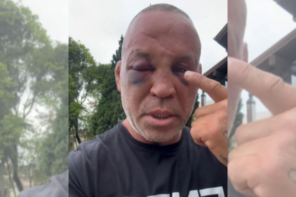 Vídeo: Wanderlei revela sequelas da agressão e promete ir à Justiça