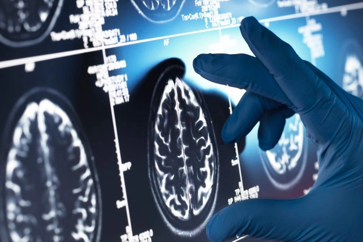 Justiça cobra exames ginecológicos e de epilepsia para pacientes no DF