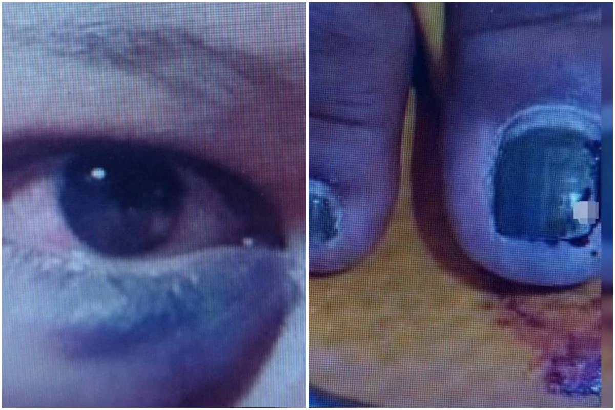 “Vou te cortar toda no facão”: homem ameaçou mulher antes de agredi-la
