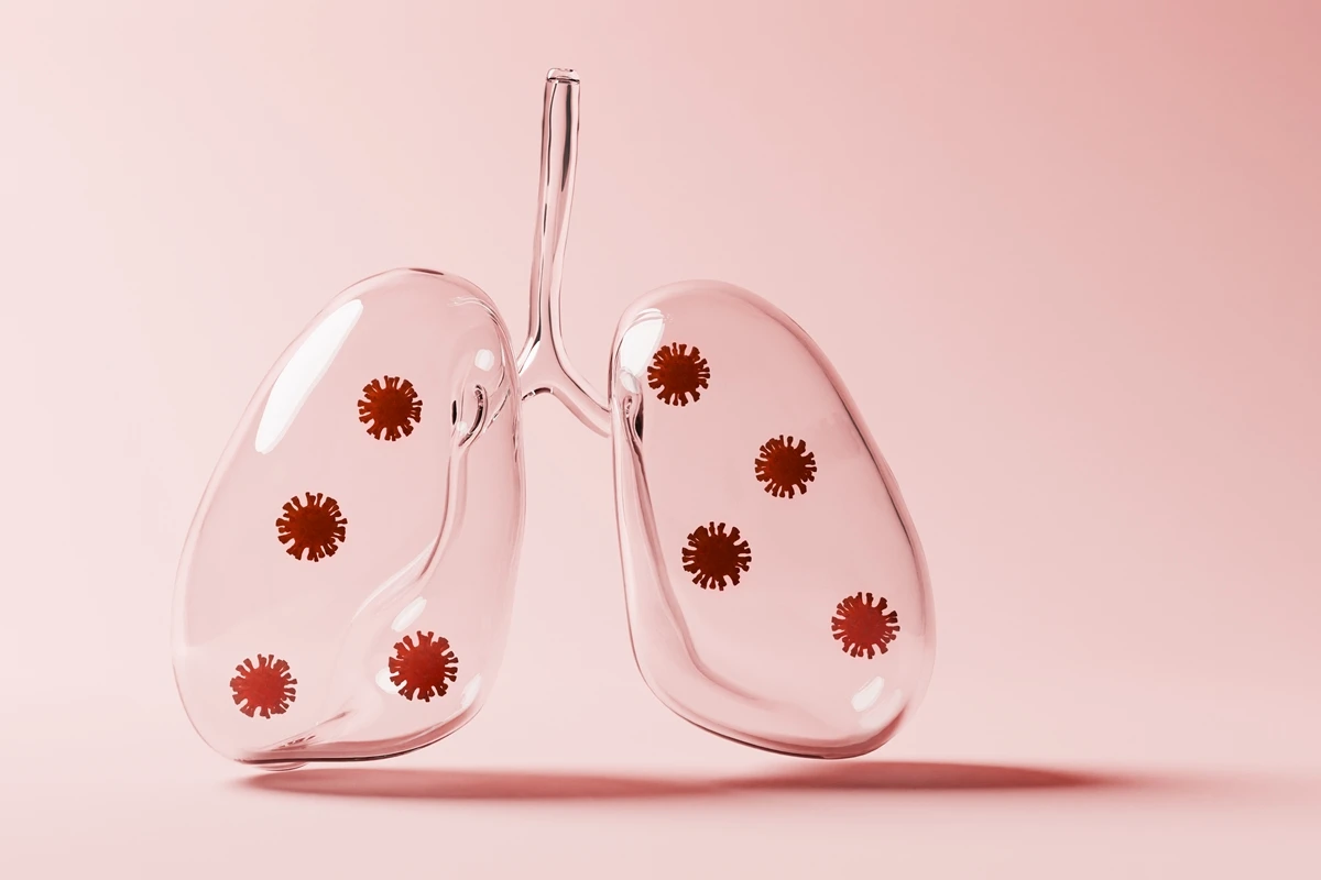 Entenda o que é pneumonia silenciosa, que tem alertado autoridades
