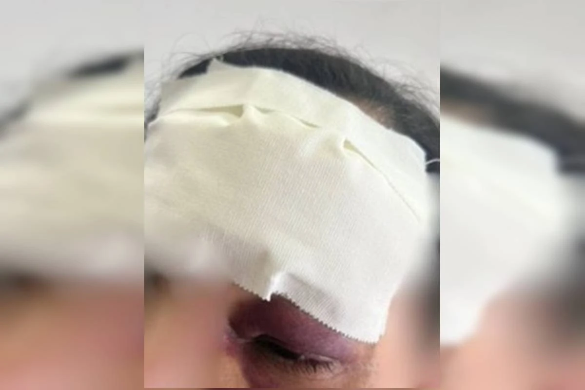 Homem ataca companheira com socos e arremessa celular no rosto dela