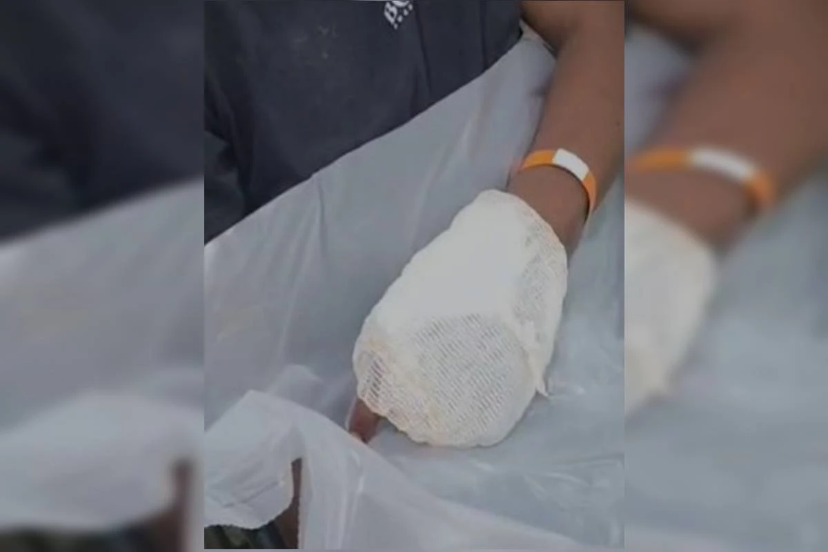 Vítima coloca mão na frente de arma e tem dedos “explodidos” por tiro