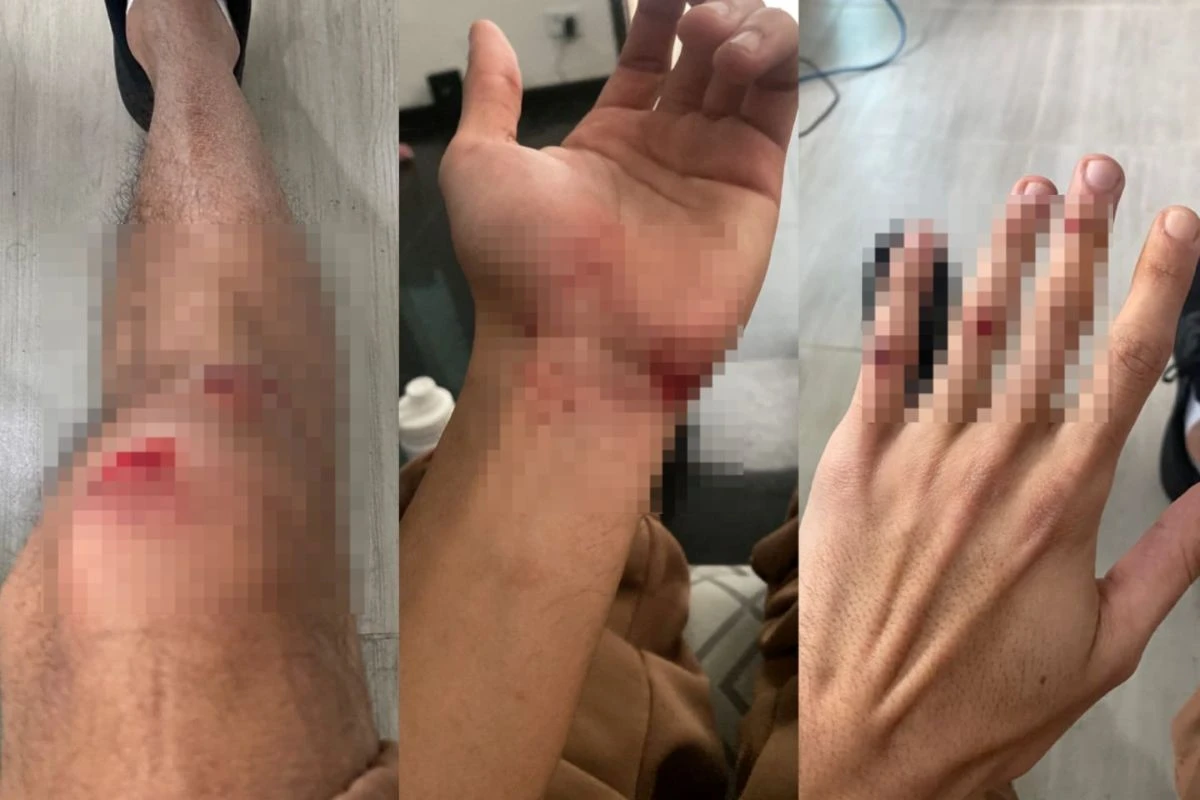 Homem espanca inquilino que descobriu “gato” em água de casa alugada