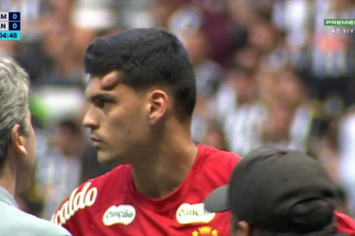 Santos explica decisão de manter Brazão em campo após choque na cabeça