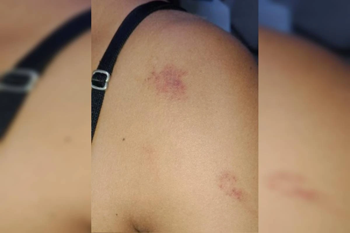 Marido é preso após agredir e deixar mulher com marcas roxas no corpo