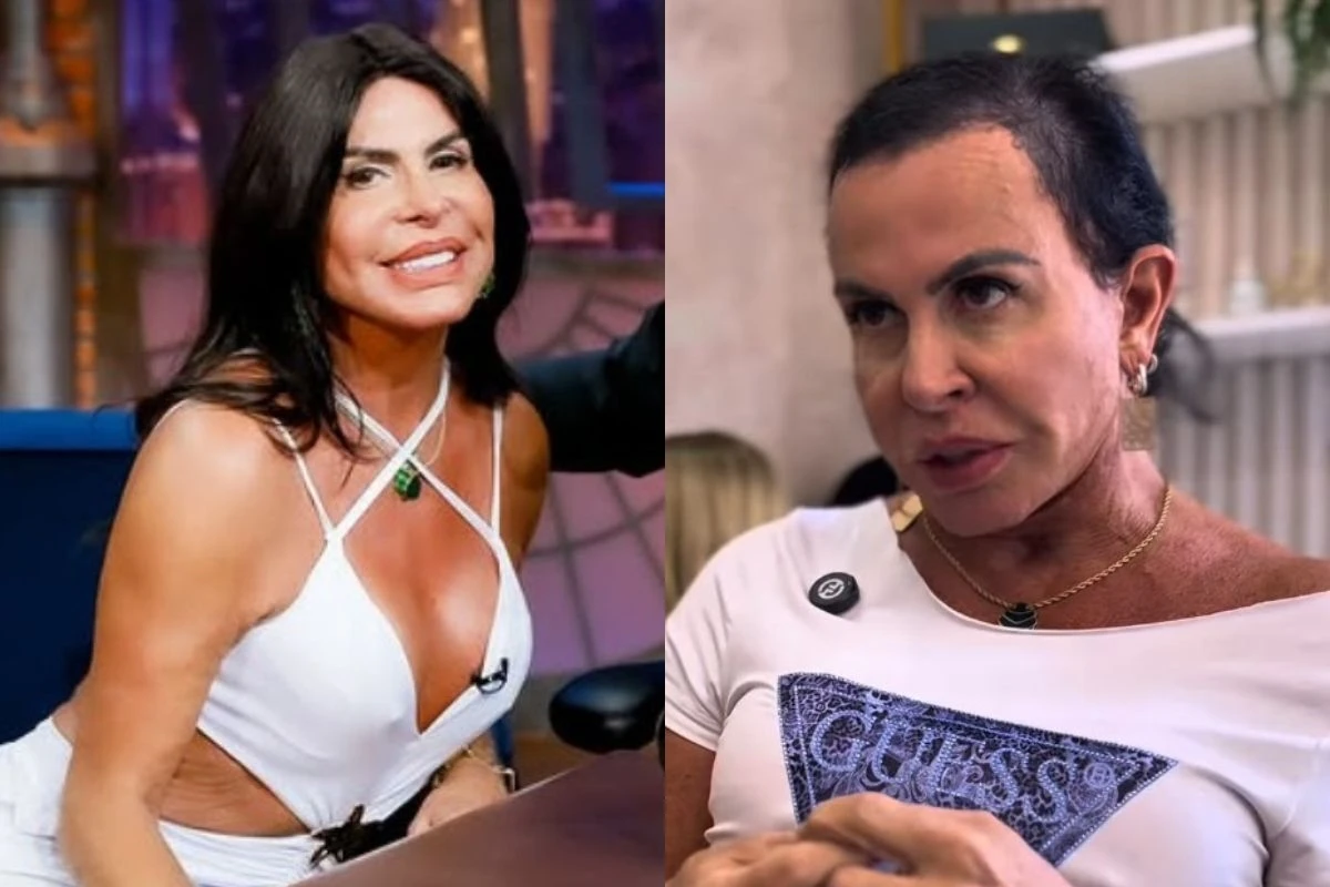 Gretchen fala sobre alopecia e médica alerta para riscos dos apliques