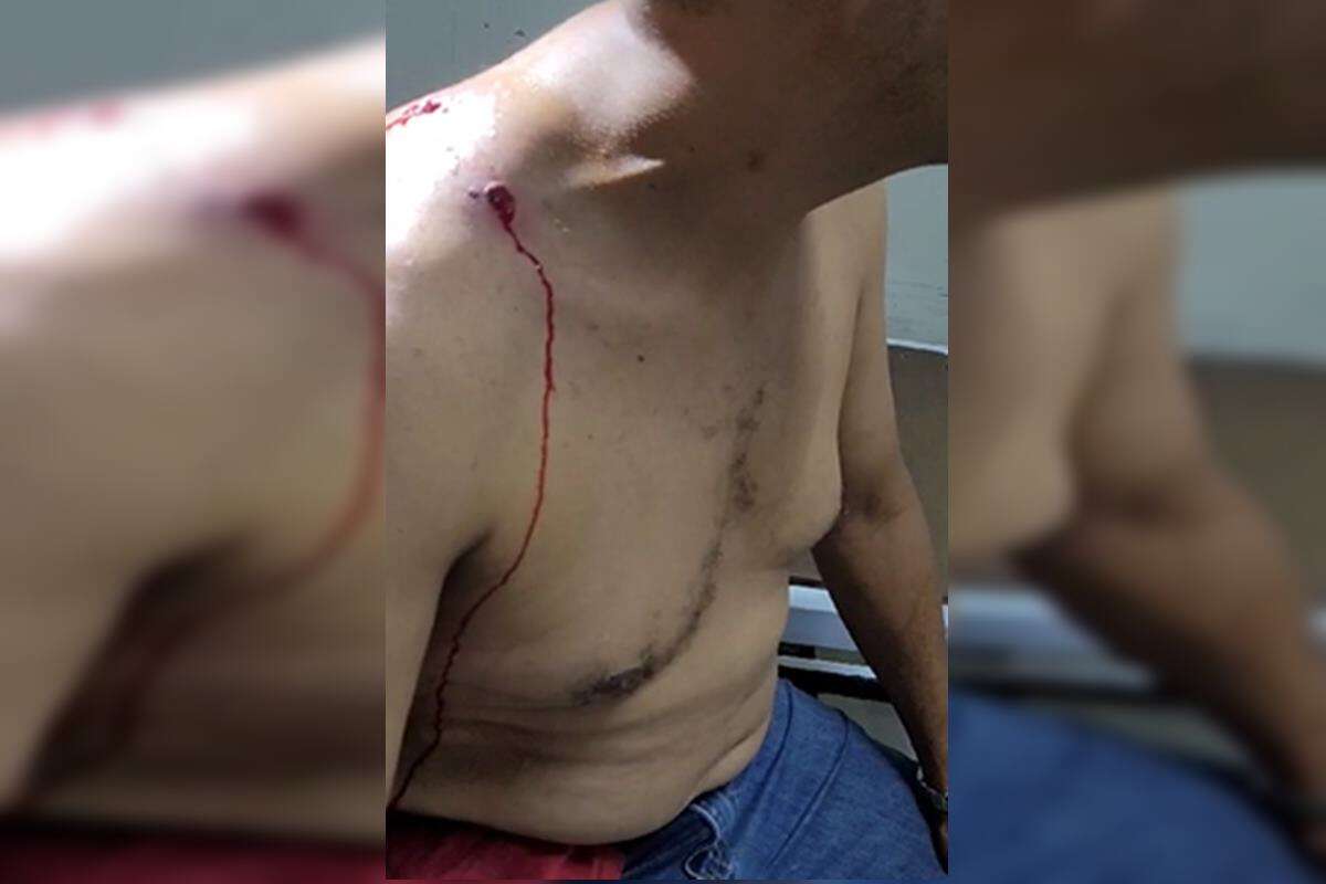 Vídeo: baleado e sangrando, candidato perseguiu atirador após disparos